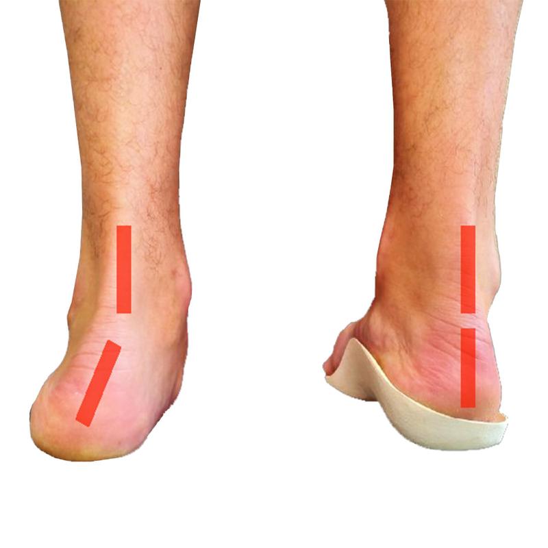 Pisada Supinada Tenis Asics Pisada Pronadora Asics Pronado Tenis