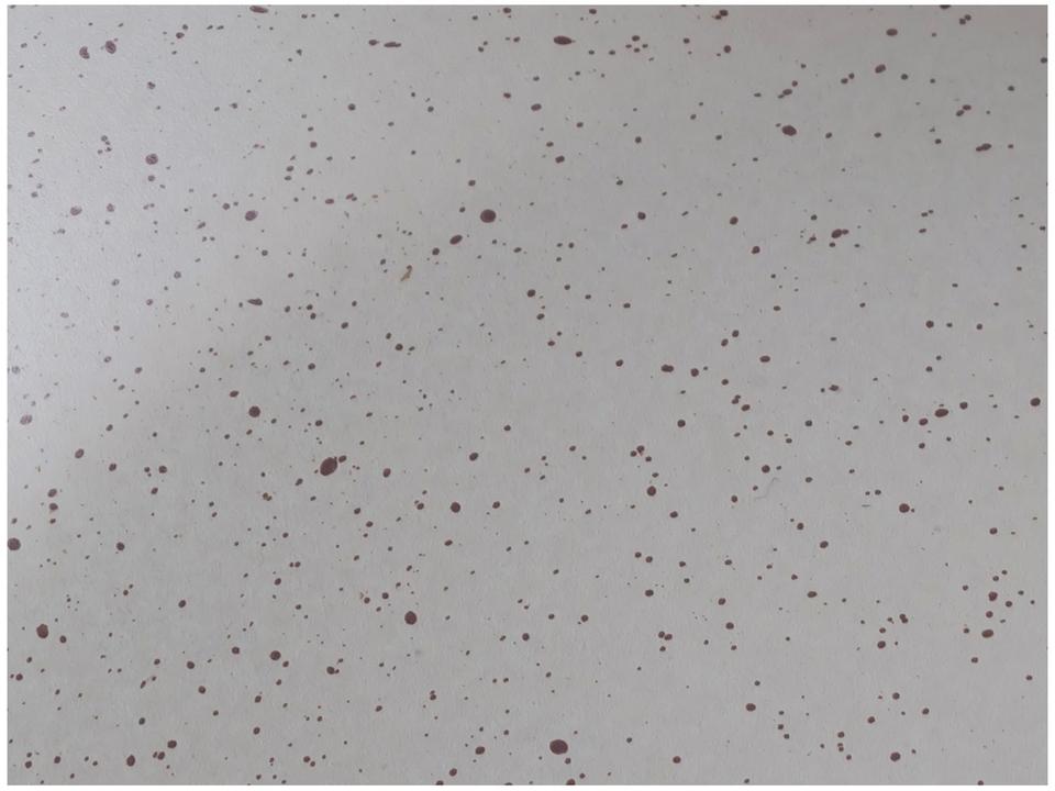 Jogo de Panelas Brinox de Alumínio Rosé 8 Peças Easy - 11