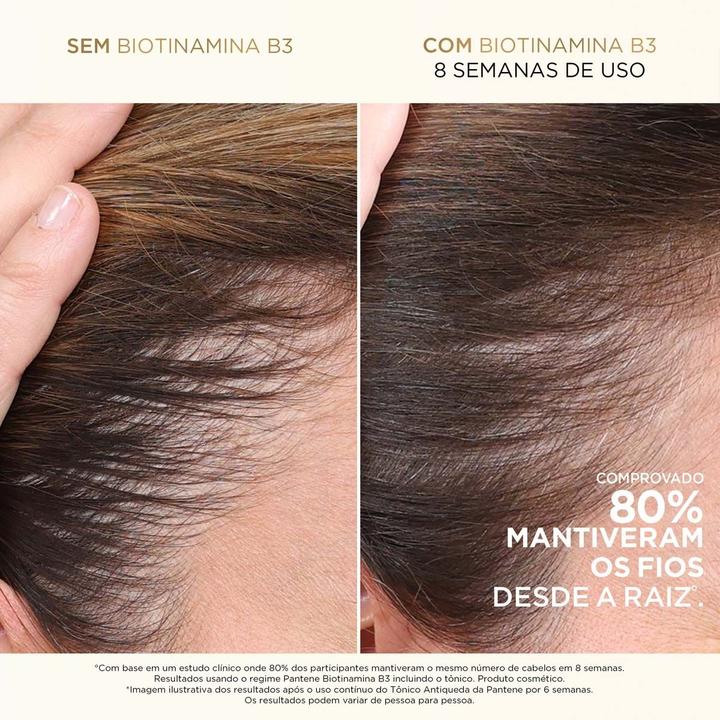 Shampoo Pro-V Miracles Biotinamina B3 Antiqueda & Nutrição 1L - 4