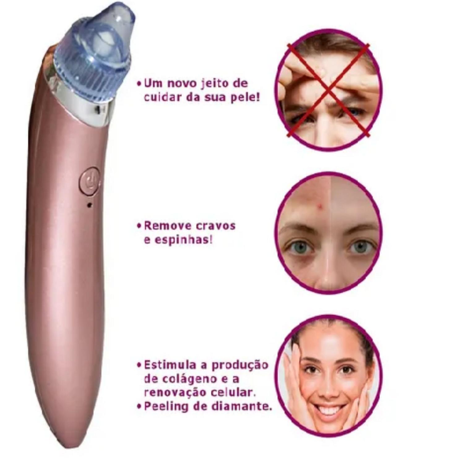 Aparelho Removedor De Cravos/espinhas Á Vácuo Limpeza Facial Bivolt ...