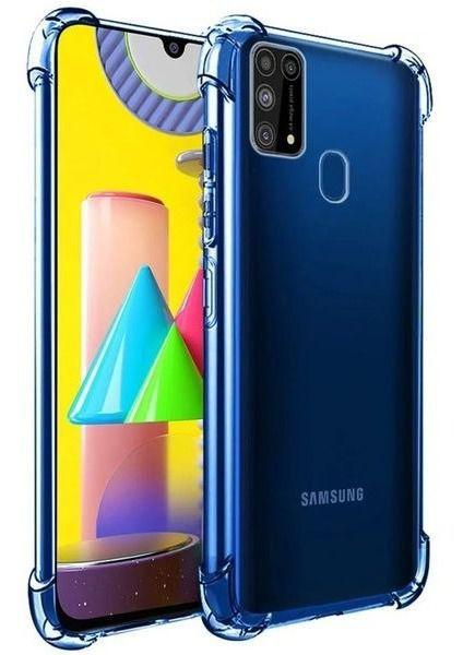 Capa Transparente Anti Impacto Para Galaxy M31 / M21 / M21s - Smart Select  - Capinha de Celular - Magazine Luiza