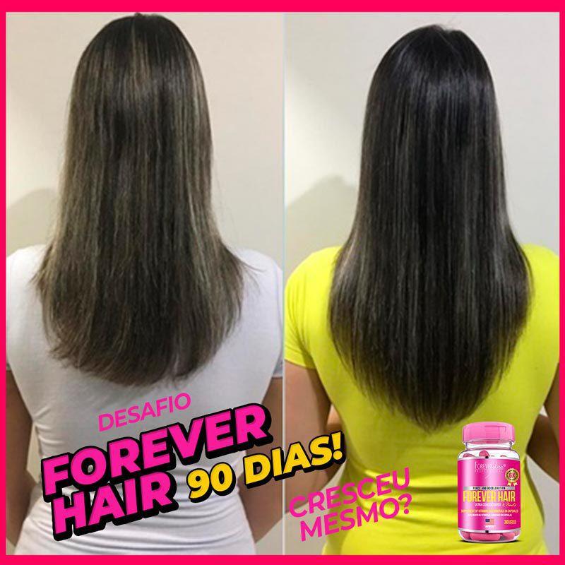 Forever Hair Crescimento Capilar Tratamento 30 dias - Forever Liss