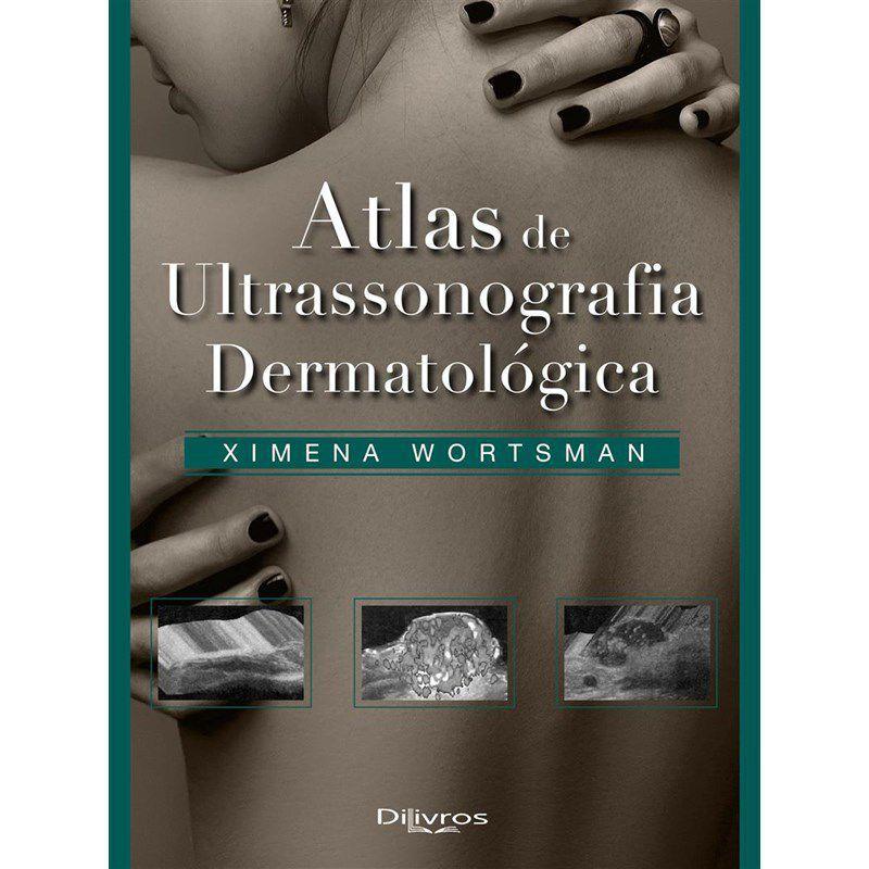 Livro Atlas De Ultrassonografia Dermatologica Wortsman Livros De Dermatologia Magazine Luiza