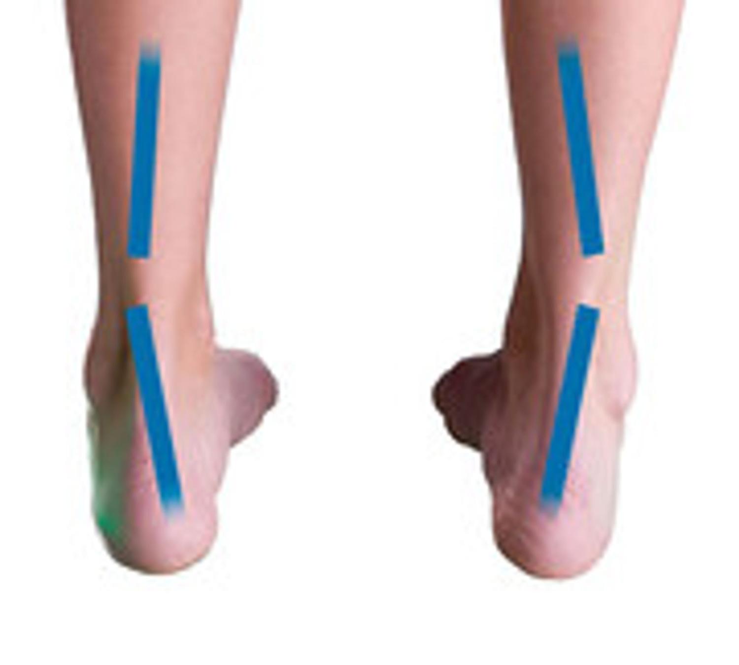 Para Pisada Supinada Adidas Pronada Para Pisada Supinada Melhores