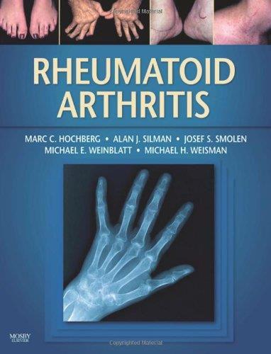 reumatoid artritisz torna