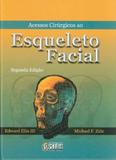 Acessos Cirúrgicos ao Esqueleto Facial - Santos