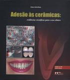 Adesão às Cerâmicas - Evidências Científicas para o Uso Clínico