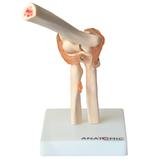 Articulação do Cotovelo c/ Ligamentos, Esqueleto anatomia - Anatomic