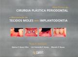 Atlas Clínico de Cirurgia Plástica Periodontal