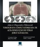 Atlas E Diagnostico Diferencial - Tomografia - Revinter