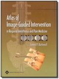 Atlas of image-guided intervention in regional ane - Lippincott