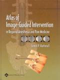Atlas of image-guided intervention in regional anesthesia and pain medicine - Lww - lippincott wilians wilkins
