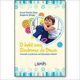 Bebe ccom Sindrome de Donw - Wak