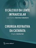 Calculo da lente intraocular, o - cirurgia refrativa da catarata - Cult medica