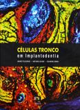 Células Tronco Em Implantodontia - Napoleão