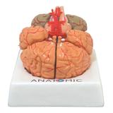 Cérebro Humano com Artérias em 9 pts Anatomia - Anatomic