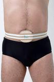 Cinta Para Hérnia Umbilical Adulto 100 Cm - Ortofly