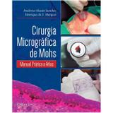 Cirurgia Micrográfica de Mohs - Di livros