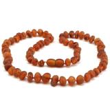 Colar de âmbar Bebê Cognac Bruto - Bem viver