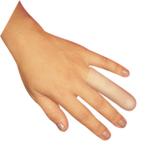 Dedeira skingel sem malha sg 103 ortho pauher
