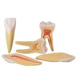 Dentes Ampliados-Canino,Incisivo e Molar Modelo Anatomia - Anatomic