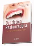 Dentística Restauradora - Santos