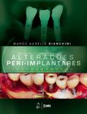 Diagnóstico e Tratamento das Alterações Peri-Implantares