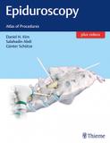 Epiduroscopy - Thieme medical publishers/mapl
