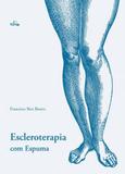 Escleroterapia com espuma - Folium