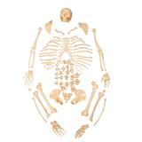 Esqueleto Humano Padrão Tamanho Natural Desarticulado - Anatomic