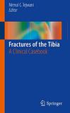 Fractures Of The Tibia - Springer (import)
