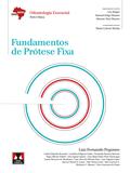 Fundamentos de Prótese Fixa