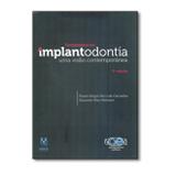 Fundamentos em Implantodontia - Uma Visão Contemporânea - Quintessence nacional