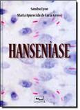 Hanseníase - Medbook