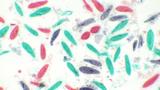 Lâminas Preparadas - Parasitologia - TIL-P-30 - Opton