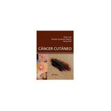 Livro - Câncer Cutâneo - Hoff - Atheneu
