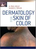 Livro Dermatology for Skin of Color - Mcgraw-hill education / medical