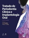 Livro - Tratado de Periodontia Clínica e Implantologia Oral
