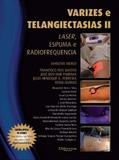 Livro Varizes E Telangiectasias IiLivroLaser, Espuma E Radiofrequencia - Di livros