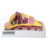 Mama dissecada com Patologias - Anatomic