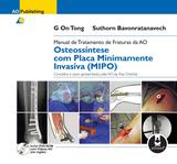 Manual de Tratamento de Fraturas da AO - Osteossíntese com Placa Minimamente Invasiva (MIPO)