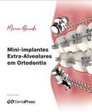 Mini-implantes Extra-alveolares Em Ortodontia - Dental press
