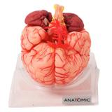 Modelo Anatômico Cérebro com Artérias com 9 Partes - Anatomic