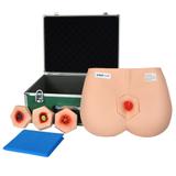 Modelo Simulador de Estágios de Úlceras por Pressão - Anatomic