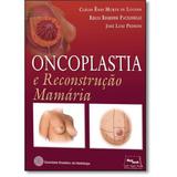 Oncoplastia E Reconstrucao Mamaria - Med book editora cientifica lt