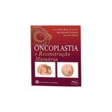 Oncoplastia e reconstrução mamária - Medbook editora cientifica