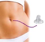 Órtese Protetor para Umbigo Anatômica Pós-Cirúrgica Silicone TM 601A - Tima