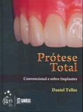 Prótese Total - Convencional e Sobre Implantes