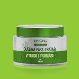Quelina 3 para tratar Vitiligo e Psoriase - 30g