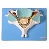 Quinta Vértebra Cervical c/ Medula Espinhal e Nervos - Anatomic